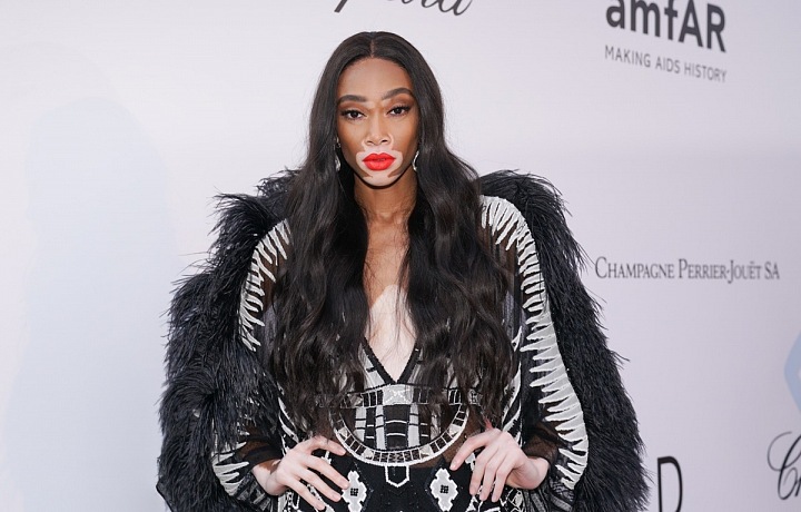 Winnie Harlow 