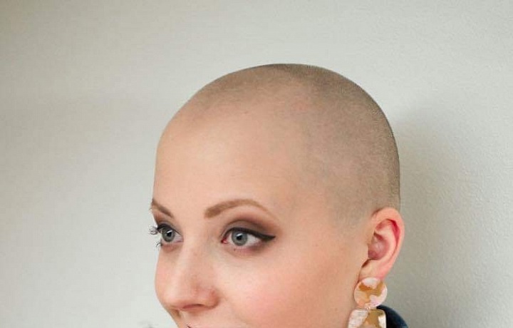 Slováčková bojuje úspěšně s rakovinou. 