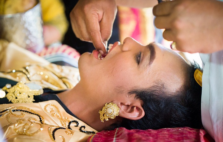 Na ostrovech Bali se rovněž udržuje dlouhá tradice pilování zubů před tím, než lidé vstoupí do manželství