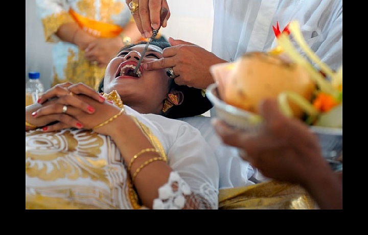 Na ostrovech Bali se rovněž udržuje dlouhá tradice pilování zubů před tím, než lidé vstoupí do manželství