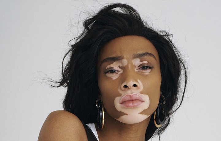 Krásná Winnie Harlow