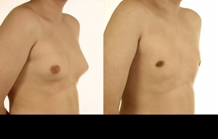 Muži by se měli nejen přestat potit, ale i dbát na své poprsí. 