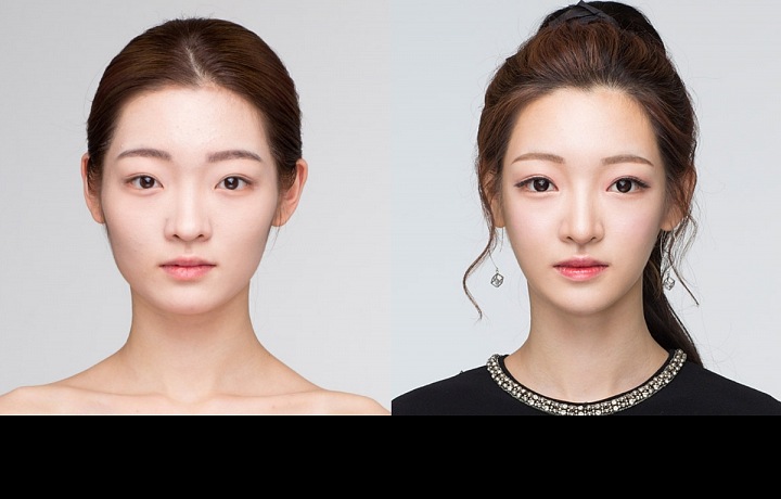 Plastická operace ženy v Jižní Koreji