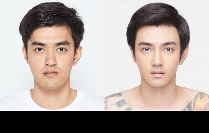 Plastická operace muže v Jižní Koreji