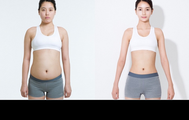 Plastická operace ženy v Jižní Koreji