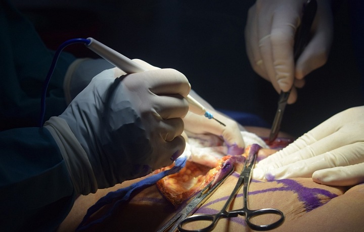 Chirurgický zákrok na sále