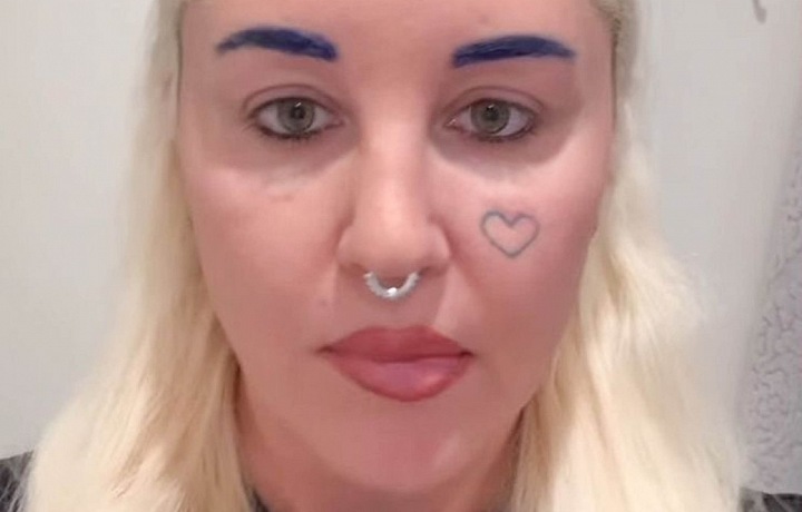 Amanda šla na blefaroplastiku