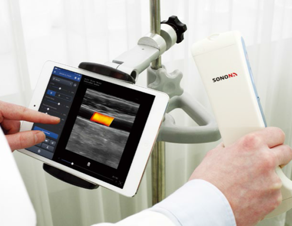 Bezdrátová ultrazvuková sonda Healcerion SONON 300L Bezdrátová ultrazvuková sonda Healcerion SONON 300L