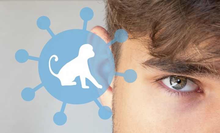 Opičí neštovice se nadále šíří, i když již menším tempem