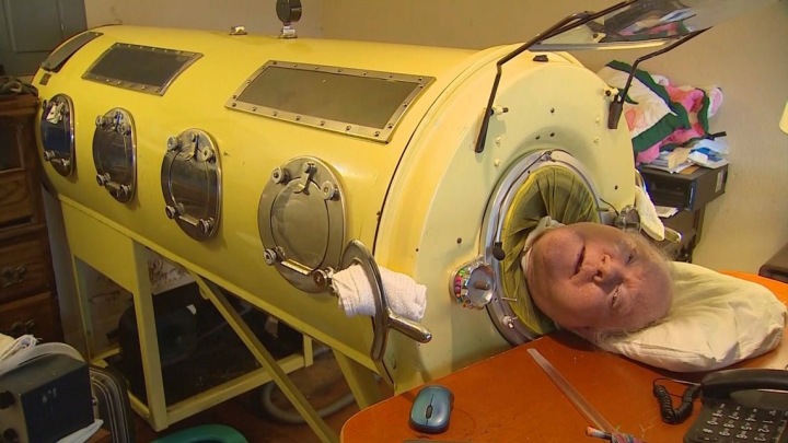 Alexander Paul dýchá ve stroji připomínajícím ponorku. 