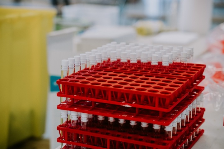 Skladování vakcín v laboratoři Skladování vakcín v laboratoři